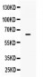 Anti-PD-L1/B7-H1 Picoband Antibody